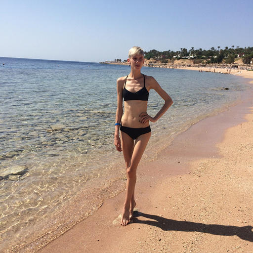Знаменитая украинская модель Маша Гребенюк призналась, что у нее анорексия